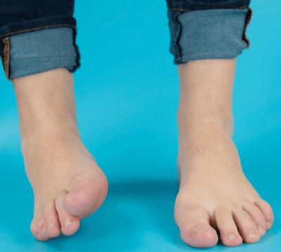 chiropractor for ankle pain