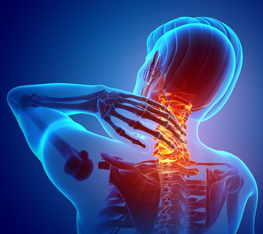 Neck Pain Chiropractors and Doctors in Ocala, Florida