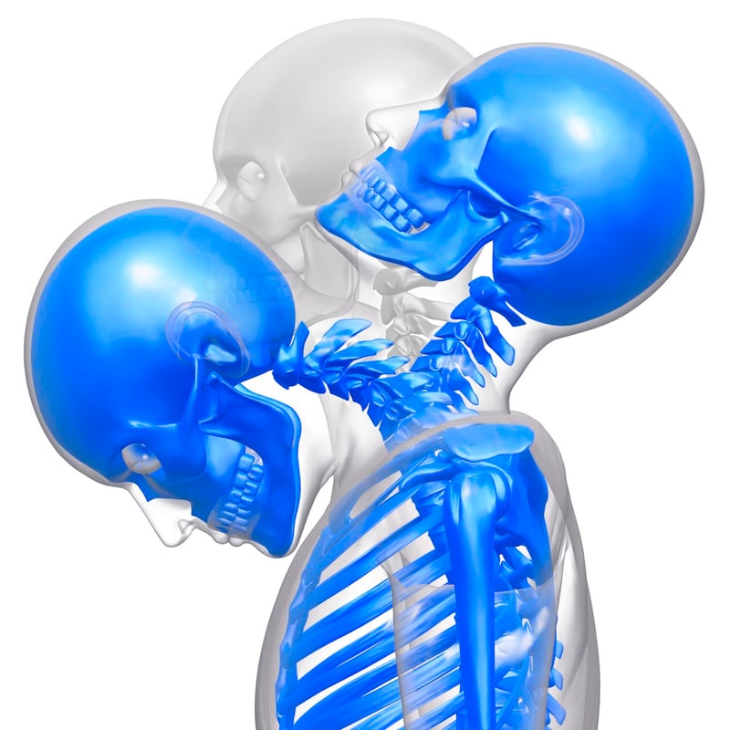 Whiplash Injury Chiropractors Near Me