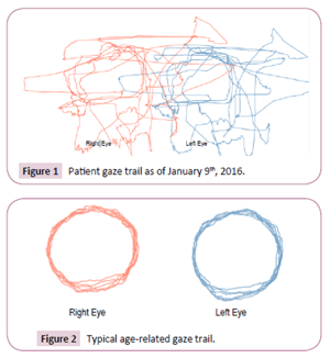 Oculomotor tracking (1)